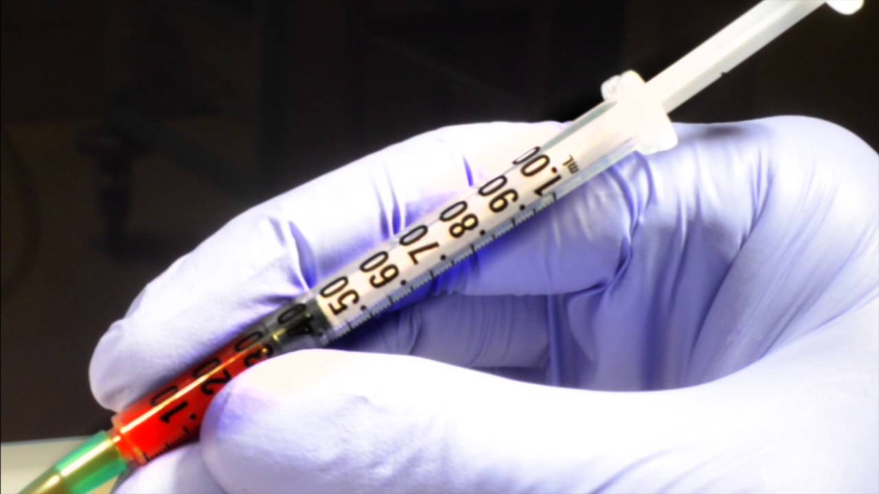 Master Arterial Blood Gas Sampling with this Comprehensive Guide